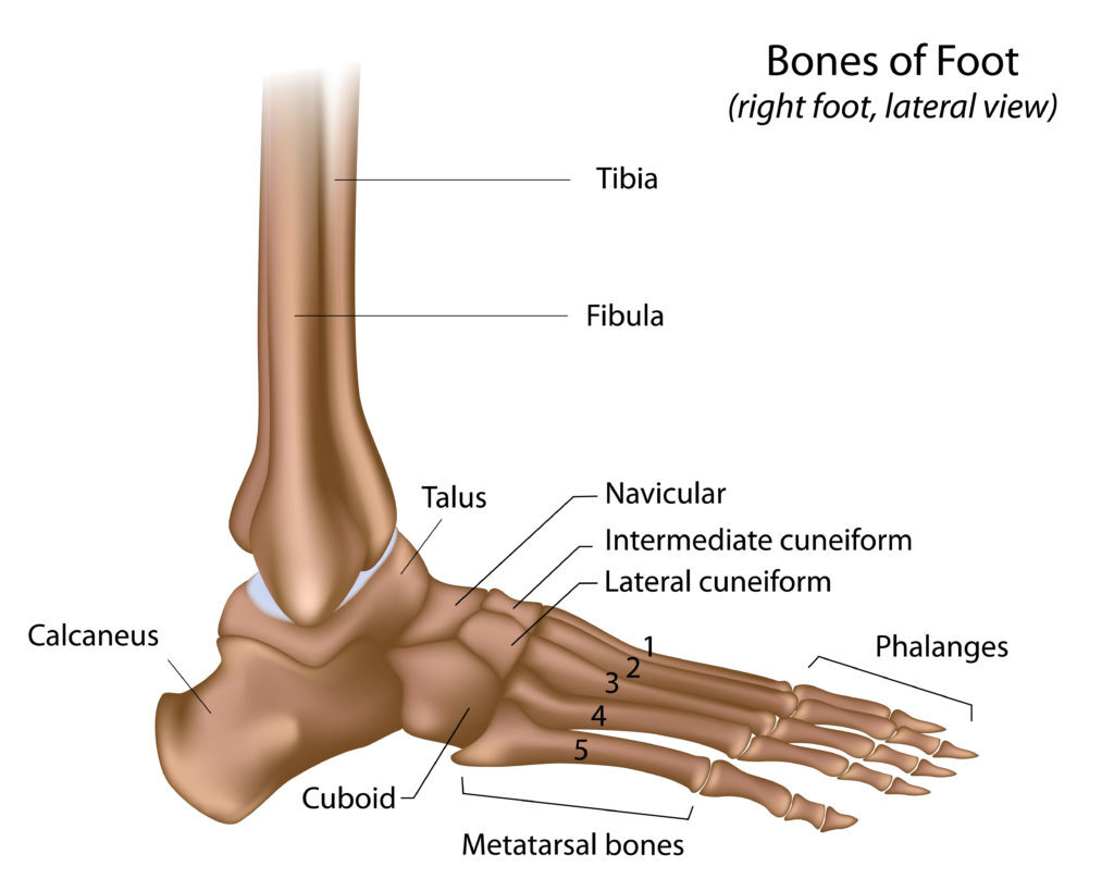 Cuboid Syndrome